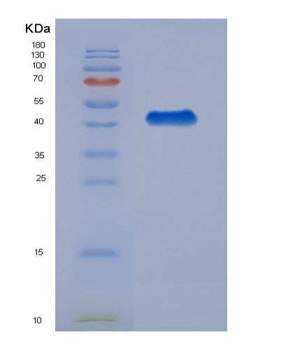SDS-PAGE analysis of Human HSPA6 (Heat Shock 70 Kda Protein 6) - Recombinant Protein, CATHuman HSPA6 (Heat Shock 70 Kda Protein 6) - Recombinant Protein