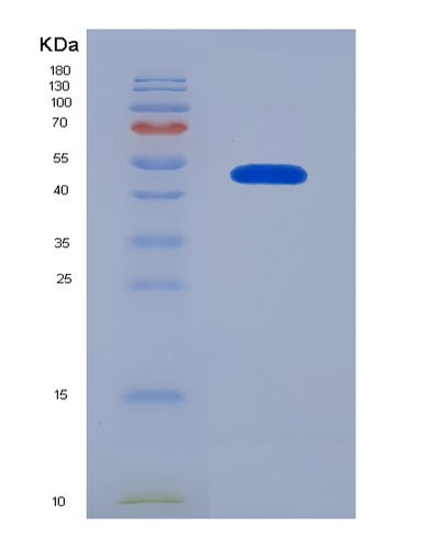 SDS-PAGE analysis of Human RHOQ (Rho-Related Gtp-Binding Protein Rhoq) - Recombinant Protein, CAT# BLT-02584P, showing >95% purity under 15% SDS-PAGE (Reduced)Human RHOQ (Rho-Related Gtp-Binding Protein Rhoq) - Recombinant Protein