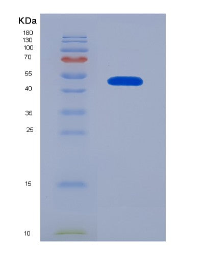 SDS-PAGE analysis of Human RHOQ (Rho-Related Gtp-Binding Protein Rhoq) - Recombinant Protein, CATHuman RHOQ (Rho-Related Gtp-Binding Protein Rhoq) - Recombinant Protein