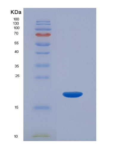 SDS-PAGE analysis of Human HBA1 (Hemoglobin Subunit Alpha) - Recombinant Protein, CAT# BLT-07564P, showing >90% purity under 15% SDS-PAGE (Reduced)Human HBA1 (Hemoglobin Subunit Alpha) - Recombinant Protein