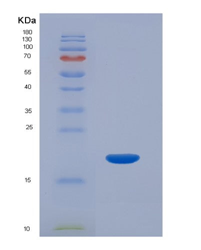 SDS-PAGE analysis of Human HBA1 (Hemoglobin Subunit Alpha) - Recombinant Protein, CATHuman HBA1 (Hemoglobin Subunit Alpha) - Recombinant Protein