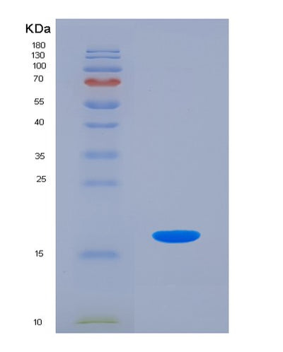 SDS-PAGE analysis of Human HMGA1 (High Mobility Group Protein Hmg-I/Hmg-Y) - Recombinant Protein, CAT# BLT-01384P, showing >85% purity under 15% SDS-PAGE (Reduced)Human HMGA1 (High Mobility Group Protein Hmg-I/Hmg-Y) - Recombinant Protein