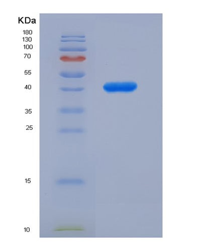 SDS-PAGE analysis of Human GOT1 (Aspartate Aminotransferase, Cytoplasmic) - Recombinant Protein, CAT# BLT-01254P, showing >90% purity under 15% SDS-PAGE (Reduced)Human GOT1 (Aspartate Aminotransferase, Cytoplasmic) - Recombinant Protein