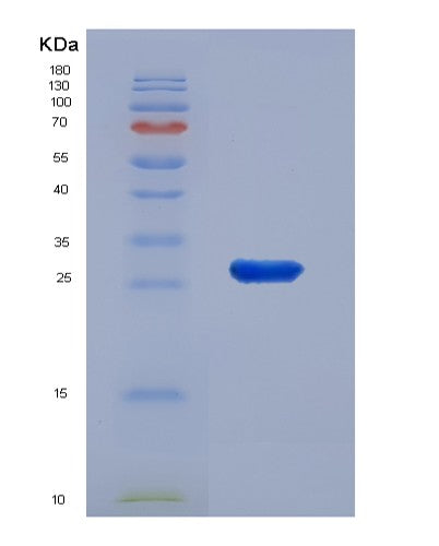 SDS-PAGE analysis of Human DES (Desmin) - Recombinant Protein, CATHuman DES (Desmin) - Recombinant Protein