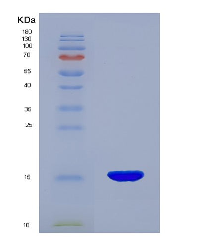 SDS-PAGE analysis of Human ENG (Endoglin) - Recombinant Protein, CAT# BLT-00977P, showing >85% purity under 15% SDS-PAGE (Reduced)Human ENG (Endoglin) - Recombinant Protein