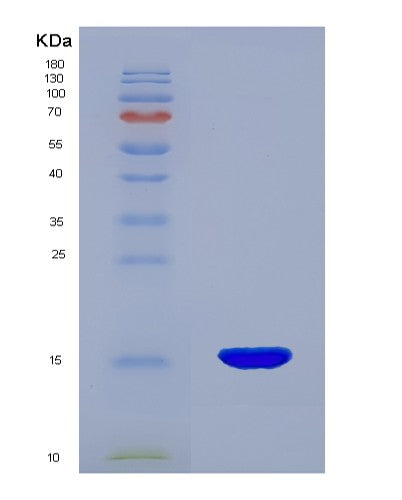 SDS-PAGE analysis of Human ENG (Endoglin) - Recombinant Protein, CATHuman ENG (Endoglin) - Recombinant Protein