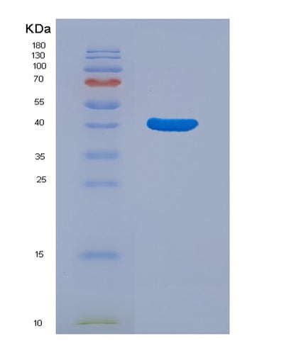 SDS-PAGE analysis of Human PTPN1 (Tyrosine-Protein Phosphatase Non-Receptor Type 1) - Recombinant Protein, CAT# BLT-07101P, showing >95% purity under 15% SDS-PAGE (Reduced)Human PTPN1 (Tyrosine-Protein Phosphatase Non-Receptor Type 1) - Recombinant Protein