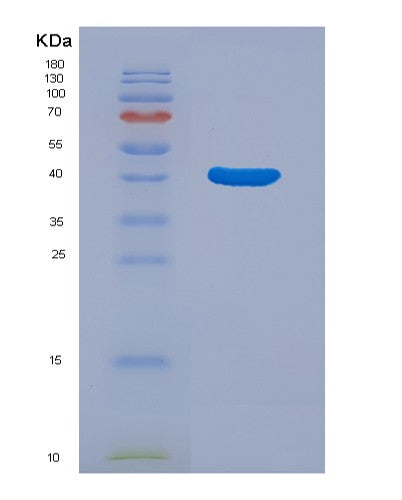 SDS-PAGE analysis of Human PTPN1 (Tyrosine-Protein Phosphatase Non-Receptor Type 1) - Recombinant Protein, CATHuman PTPN1 (Tyrosine-Protein Phosphatase Non-Receptor Type 1) - Recombinant Protein