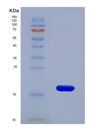 SDS-PAGE analysis of Mouse Cxcl9 (C-X-C Motif Chemokine 9) - Recombinant Protein, CAT# BLT-04467P, showing >90% purity under 15% SDS-PAGE (Reduced)Mouse Cxcl9 (C-X-C Motif Chemokine 9) - Recombinant Protein