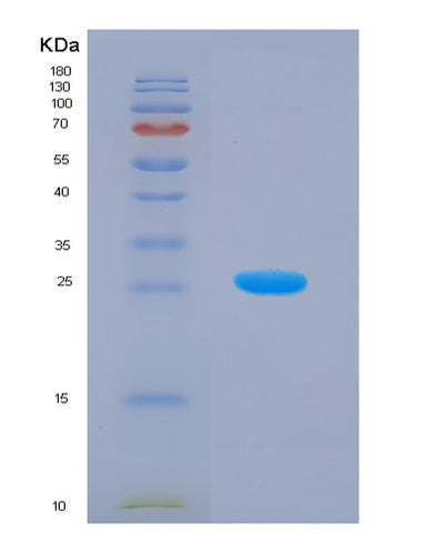 SDS-PAGE analysis of Human GNAZ (Guanine Nucleotide-Binding Protein G(Z) Subunit Alpha) - Recombinant Protein, CAT# BLT-01235P, showing >85% purity under 15% SDS-PAGE (Reduced)Human GNAZ (Guanine Nucleotide-Binding Protein G(Z) Subunit Alpha) - Recombinant Protein