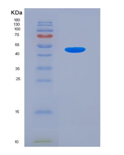SDS-PAGE analysis of Human VCAM1 (Vascular Cell Adhesion Protein 1) - Recombinant Protein, CAT# BLT-03278P, showing >85% purity under 15% SDS-PAGE (Reduced)Human VCAM1 (Vascular Cell Adhesion Protein 1) - Recombinant Protein