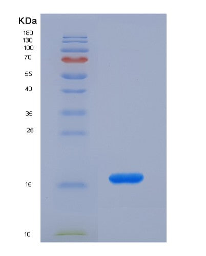 SDS-PAGE analysis of Human HK1 (Hexokinase-1) - Recombinant Protein, CATHuman HK1 (Hexokinase-1) - Recombinant Protein