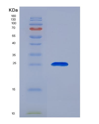SDS-PAGE analysis of Human ORM2 (Alpha-1-Acid Glycoprotein 2) - Recombinant Protein, CAT# BLT-02123P, showing >85% purity under 15% SDS-PAGE (Reduced)Human ORM2 (Alpha-1-Acid Glycoprotein 2) - Recombinant Protein