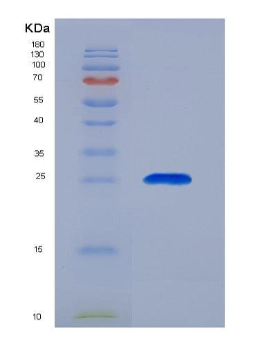 SDS-PAGE analysis of Human ORM2 (Alpha-1-Acid Glycoprotein 2) - Recombinant Protein, CATHuman ORM2 (Alpha-1-Acid Glycoprotein 2) - Recombinant Protein
