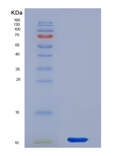 SDS-PAGE analysis of Human CXCL2 (C-X-C Motif Chemokine 2) - Recombinant Protein, CAT# BLT-00776P, showing >90% purity under 15% SDS-PAGE (Reduced)Human CXCL2 (C-X-C Motif Chemokine 2) - Recombinant Protein