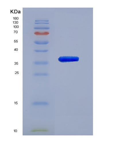 SDS-PAGE analysis of Human CHI3L2 (Chitinase-3-Like Protein 2) - Recombinant Protein, CAT# BLT-07572P, showing >90% purity under 15% SDS-PAGE (Reduced)Human CHI3L2 (Chitinase-3-Like Protein 2) - Recombinant Protein