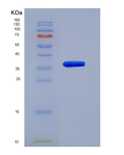 SDS-PAGE analysis of Human CHI3L2 (Chitinase-3-Like Protein 2) - Recombinant Protein, CATHuman CHI3L2 (Chitinase-3-Like Protein 2) - Recombinant Protein