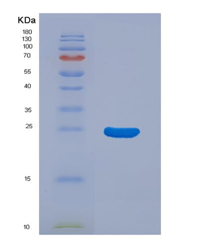 SDS-PAGE analysis of Human TYMP (Thymidine Phosphorylase) - Recombinant Protein, CAT# BLT-03182P, showing >85% purity under 15% SDS-PAGE (Reduced)Human TYMP (Thymidine Phosphorylase) - Recombinant Protein