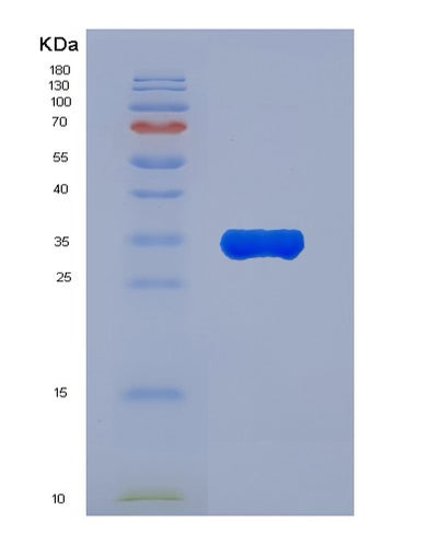 SDS-PAGE analysis of Human ANXA7 (Annexin A7) - Recombinant Protein, CAT# BLT-00175P, showing >85% purity under 15% SDS-PAGE (Reduced)Human ANXA7 (Annexin A7) - Recombinant Protein
