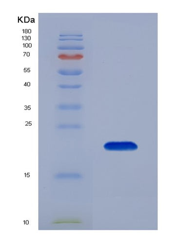 SDS-PAGE analysis of Mouse Lif (Leukemia Inhibitory Factor) - Recombinant Protein, CAT# BLT-07573P, showing >90% purity under 15% SDS-PAGE (Reduced)Mouse Lif (Leukemia Inhibitory Factor) - Recombinant Protein