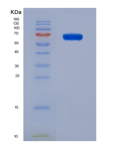 SDS-PAGE analysis of Mouse Irf1 (Interferon Regulatory Factor 1) - Recombinant Protein, CAT# BLT-07574P, showing >90% purity under 15% SDS-PAGE (Reduced)Mouse Irf1 (Interferon Regulatory Factor 1) - Recombinant Protein
