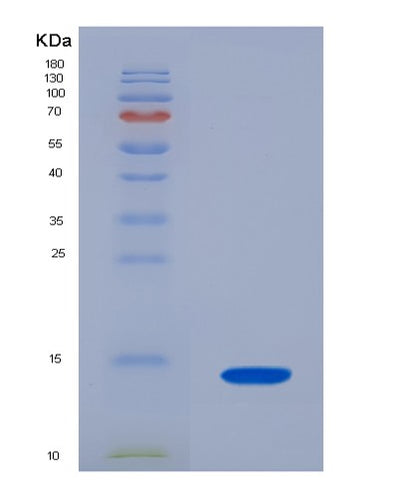SDS-PAGE analysis of Mouse Slc7a11 (Cystine/Glutamate Transporter) - Recombinant Protein, CAT# BLT-07575P, showing >90% purity under 15% SDS-PAGE (Reduced)Mouse Slc7a11 (Cystine/Glutamate Transporter) - Recombinant Protein
