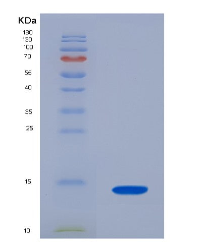 SDS-PAGE analysis of Mouse Slc7a11 (Cystine/Glutamate Transporter) - Recombinant Protein, CATMouse Slc7a11 (Cystine/Glutamate Transporter) - Recombinant Protein