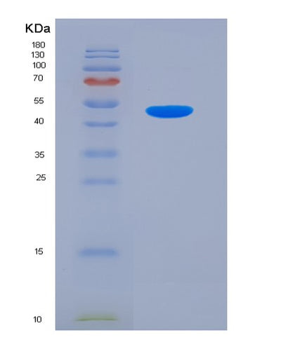 SDS-PAGE analysis of Mouse Nr1h4 (Bile Acid Receptor) - Recombinant Protein, CAT# BLT-07577P, showing >90% purity under 15% SDS-PAGE (Reduced)Mouse Nr1h4 (Bile Acid Receptor) - Recombinant Protein