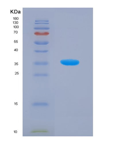 SDS-PAGE analysis of Human SIRT4 (Nad-Dependent Protein Lipoamidase Sirtuin-4, Mitochondrial) - Recombinant Protein, CAT# BLT-07578P, showing >90% purity under 15% SDS-PAGE (Reduced)Human SIRT4 (Nad-Dependent Protein Lipoamidase Sirtuin-4, Mitochondrial) - Recombinant Protein