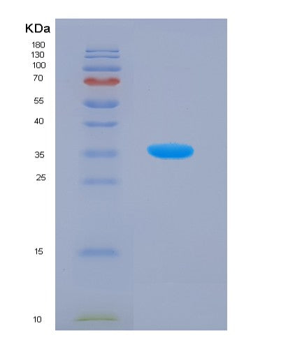 SDS-PAGE analysis of Human SIRT4 (Nad-Dependent Protein Lipoamidase Sirtuin-4, Mitochondrial) - Recombinant Protein, CATHuman SIRT4 (Nad-Dependent Protein Lipoamidase Sirtuin-4, Mitochondrial) - Recombinant Protein