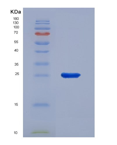 SDS-PAGE analysis of Human PTGER4 (Prostaglandin E2 Receptor Ep4 Subtype) - Recombinant Protein, CATHuman PTGER4 (Prostaglandin E2 Receptor Ep4 Subtype) - Recombinant Protein
