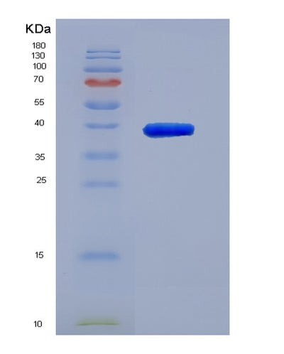 SDS-PAGE analysis of Human MX2 (Interferon-Induced Gtp-Binding Protein Mx2) - Recombinant Protein, CAT# BLT-01930P, showing >85% purity under 15% SDS-PAGE (Reduced)Human MX2 (Interferon-Induced Gtp-Binding Protein Mx2) - Recombinant Protein