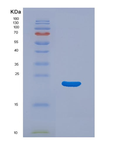 SDS-PAGE analysis of Human M6PR (Cation-Dependent Mannose-6-Phosphate Receptor) - Recombinant Protein, CAT# BLT-01762P, showing >90% purity under 15% SDS-PAGE (Reduced)Human M6PR (Cation-Dependent Mannose-6-Phosphate Receptor) - Recombinant Protein
