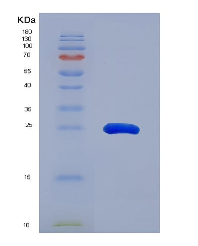 SDS-PAGE analysis of Human DDC (Aromatic-L-Amino-Acid Decarboxylase) - Recombinant Protein, CAT# BLT-00881P, showing >95% purity under 15% SDS-PAGE (Reduced)Human DDC (Aromatic-L-Amino-Acid Decarboxylase) - Recombinant Protein