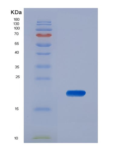 SDS-PAGE analysis of Mouse Kitlg (Kit Ligand) - Recombinant Protein, CAT# BLT-02701P, showing >85% purity under 15% SDS-PAGE (Reduced)Mouse Kitlg (Kit Ligand) - Recombinant Protein