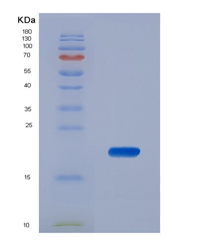 SDS-PAGE analysis of Mouse Kitlg (Kit Ligand) - Recombinant Protein, CATMouse Kitlg (Kit Ligand) - Recombinant Protein