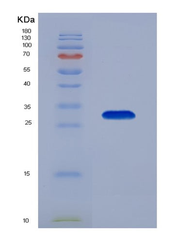 SDS-PAGE analysis of Human AGA (N(4)-(Beta-N-Acetylglucosaminyl)-L-Asparaginase) - Recombinant Protein, CAT# BLT-00079P, showing >85% purity under 15% SDS-PAGE (Reduced)Human AGA (N(4)-(Beta-N-Acetylglucosaminyl)-L-Asparaginase) - Recombinant Protein