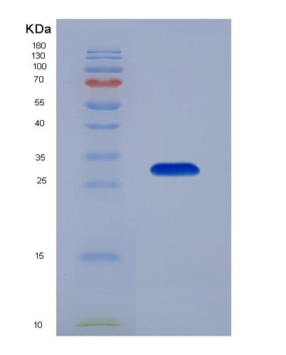 SDS-PAGE analysis of Human AGA (N(4)-(Beta-N-Acetylglucosaminyl)-L-Asparaginase) - Recombinant Protein, CATHuman AGA (N(4)-(Beta-N-Acetylglucosaminyl)-L-Asparaginase) - Recombinant Protein
