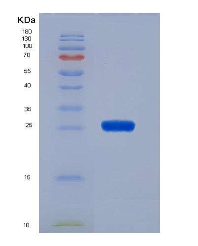 SDS-PAGE analysis of Human GSTM3 (Glutathione S-Transferase Mu 3) - Recombinant Protein, CATHuman GSTM3 (Glutathione S-Transferase Mu 3) - Recombinant Protein