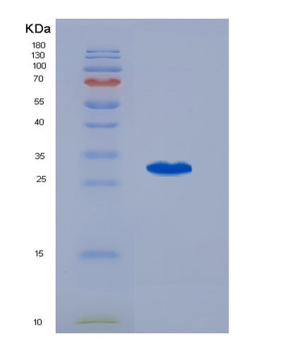 SDS-PAGE analysis of Human IGFBP1 (Insulin-Like Growth Factor-Binding Protein 1) - Recombinant Protein, CAT# BLT-07583P, showing >90% purity under 15% SDS-PAGE (Reduced)Human IGFBP1 (Insulin-Like Growth Factor-Binding Protein 1) - Recombinant Protein