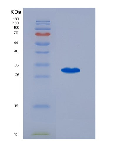 SDS-PAGE analysis of Human IGFBP1 (Insulin-Like Growth Factor-Binding Protein 1) - Recombinant Protein, CATHuman IGFBP1 (Insulin-Like Growth Factor-Binding Protein 1) - Recombinant Protein