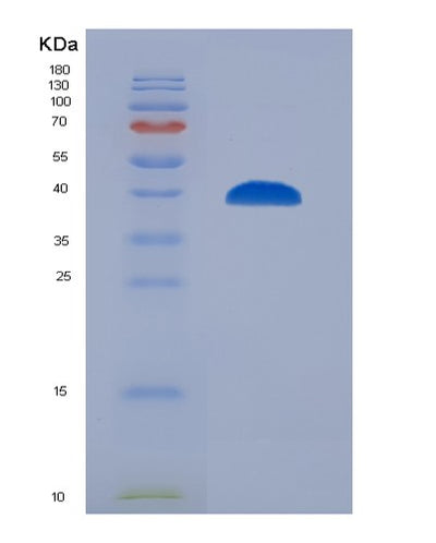 SDS-PAGE analysis of Human SYT1 (Synaptotagmin-1) - Recombinant Protein, CAT# BLT-02955P, showing >90% purity under 15% SDS-PAGE (Reduced)Human SYT1 (Synaptotagmin-1) - Recombinant Protein