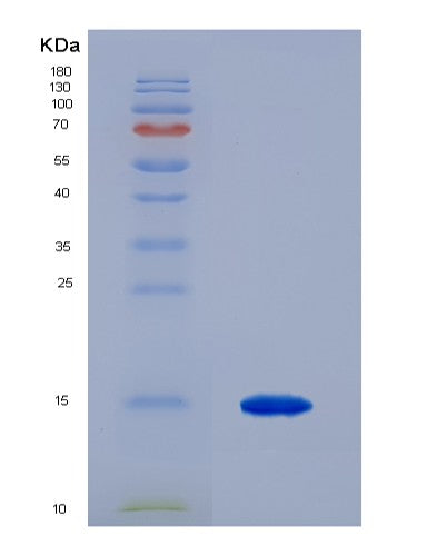 SDS-PAGE analysis of Mouse Ubap2 (Ubiquitin-Associated Protein 2) - Recombinant Protein, CATMouse Ubap2 (Ubiquitin-Associated Protein 2) - Recombinant Protein