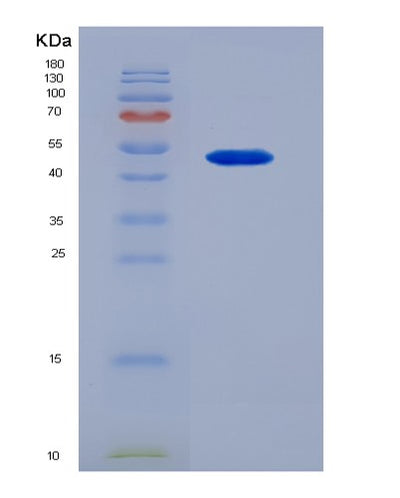 SDS-PAGE analysis of Human NT5E (5'-Nucleotidase) - Recombinant Protein, CAT# BLT-02076P, showing >95% purity under 15% SDS-PAGE (Reduced)Human NT5E (5'-Nucleotidase) - Recombinant Protein