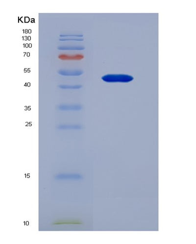 SDS-PAGE analysis of Human MSR1 (Macrophage Scavenger Receptor Types I And Ii) - Recombinant Protein, CAT# BLT-01912P, showing >95% purity under 15% SDS-PAGE (Reduced)Human MSR1 (Macrophage Scavenger Receptor Types I And Ii) - Recombinant Protein