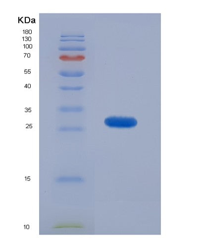 SDS-PAGE analysis of Human KRT18 (Keratin, Type I Cytoskeletal 18) - Recombinant Protein, CATHuman KRT18 (Keratin, Type I Cytoskeletal 18) - Recombinant Protein