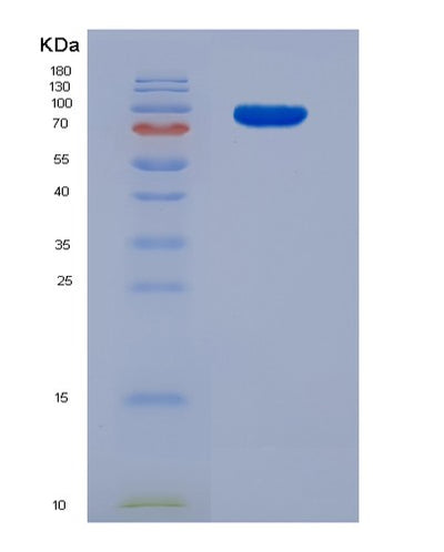 SDS-PAGE analysis of Human TGM2 (Protein-Glutamine Gamma-Glutamyltransferase 2) - Recombinant Protein, CAT# BLT-03024P, showing >85% purity under 15% SDS-PAGE (Reduced)Human TGM2 (Protein-Glutamine Gamma-Glutamyltransferase 2) - Recombinant Protein