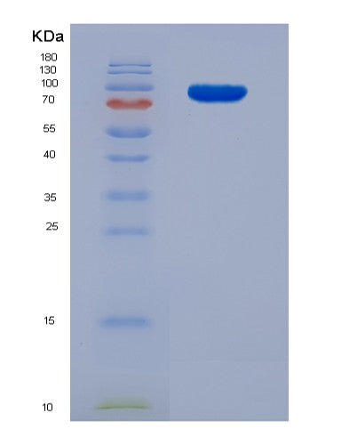 SDS-PAGE analysis of Human TGM2 (Protein-Glutamine Gamma-Glutamyltransferase 2) - Recombinant Protein, CATHuman TGM2 (Protein-Glutamine Gamma-Glutamyltransferase 2) - Recombinant Protein