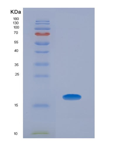 SDS-PAGE analysis of Human BMP5 (Bone Morphogenetic Protein 5) - Recombinant Protein, CAT# BLT-00339P, showing >85% purity under 15% SDS-PAGE (Reduced)Human BMP5 (Bone Morphogenetic Protein 5) - Recombinant Protein