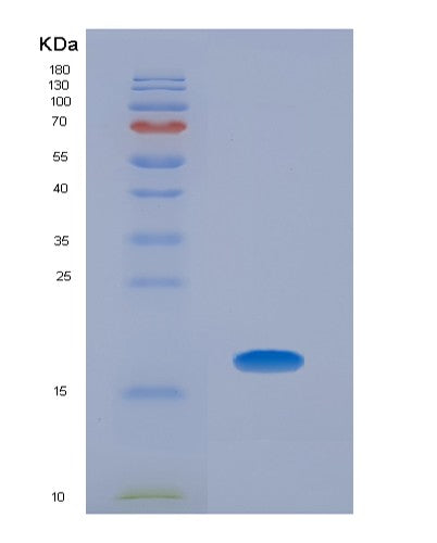 SDS-PAGE analysis of Human BMP5 (Bone Morphogenetic Protein 5) - Recombinant Protein, CATHuman BMP5 (Bone Morphogenetic Protein 5) - Recombinant Protein